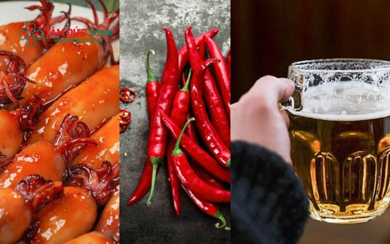 Cần tuyệt đối kiêng đồ cứng, cay nóng và các chất kích thích trong những ngày đầu để bảo vệ cục máu đông, tránh gây chảy máu kéo dài hoặc viêm ổ răng khô