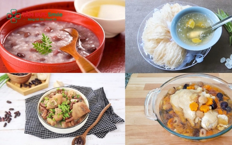 Ưu tiên thực phẩm mềm, lỏng và nguội như cháo, súp hoặc sữa chua để cung cấp đủ dưỡng chất mà không làm ảnh hưởng đến vết thương.