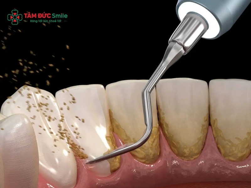 Cách làm rụng Abc8com nổ hũ tại nhà và những lưu ý nên biết khi thực hiện Abc88bet phiên bản mới tại nhà
