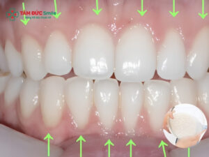 Cách làm trắng răng bằng nước vo gạo tại nhà