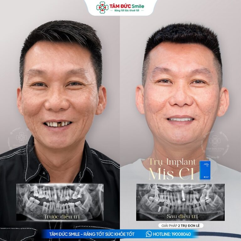 khach-hang-duc-tran-1