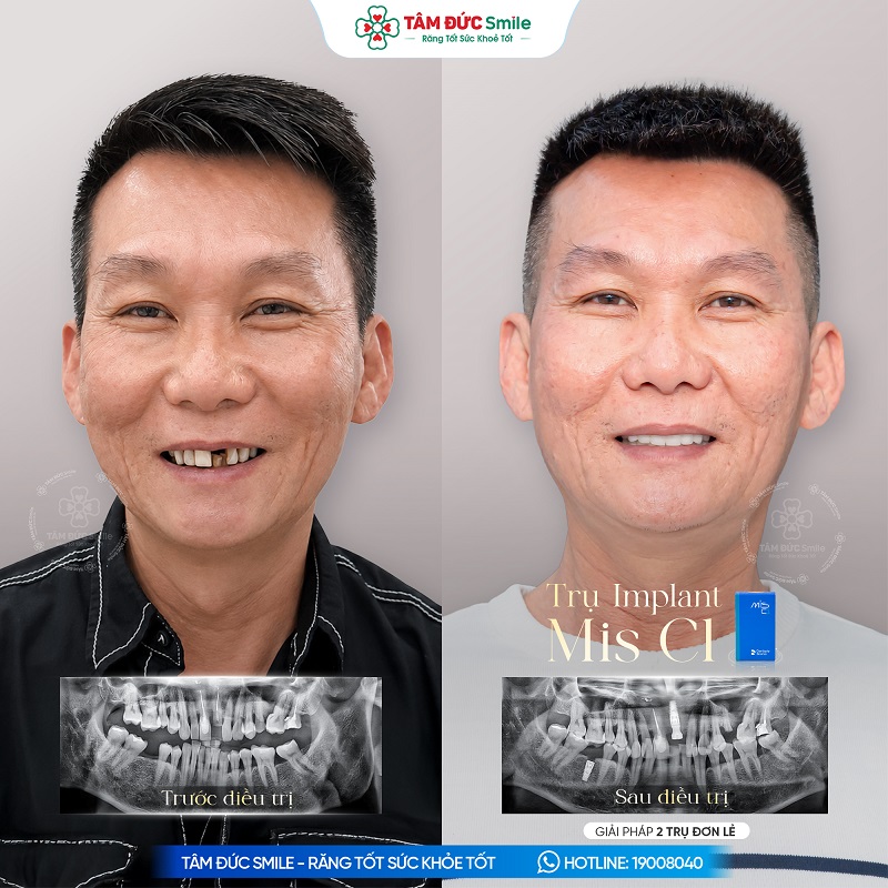 khach-hang-duc-tran-1