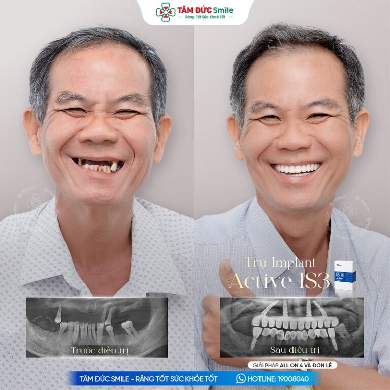 khach-hang-thanh-son-1