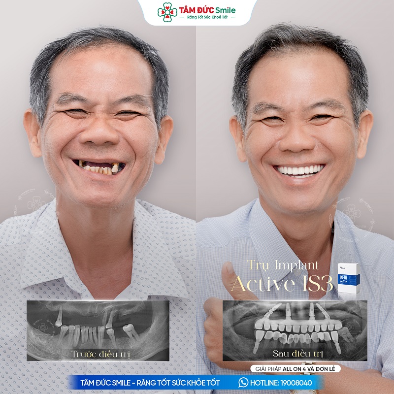khach-hang-thanh-son-1