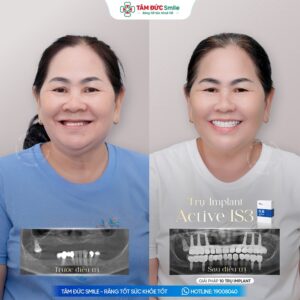 khach-hang-thu-suong-1