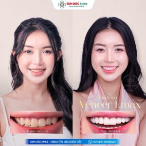 khach-hang-thuy-trang