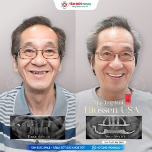 khach-hang-tran-loi