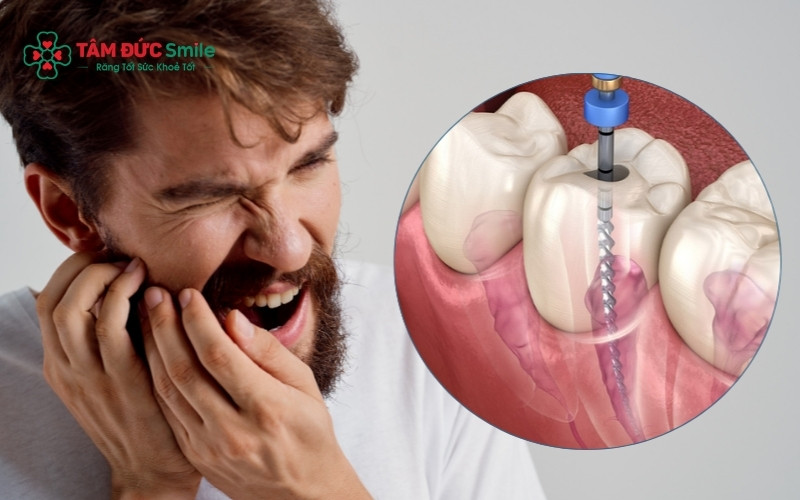 Nếu cơn đau nhức không thuyên giảm hoặc xuất hiện nốt mủ ở nướu sau khi Abc8b tỷ lệ kèo World Cup 2026 tủy, đây là dấu hiệu cho thấy ổ viêm vẫn còn sót lại bên trong ống tủy