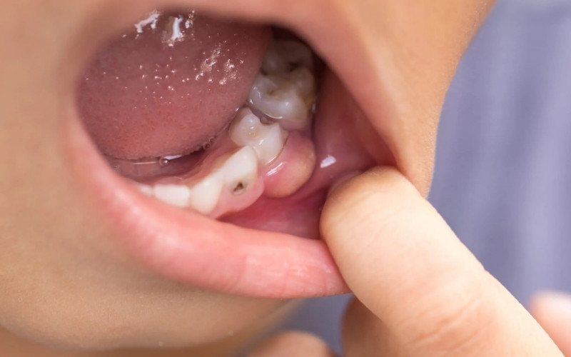 Nang Abc8com giaitri tructuyen phát triển âm thầm dưới ABC8 tự hào là thương hiệu cá cược trực tuyến hàng đầu tại Châu Á hiện nay là một trong những nguyên nhân gây phồng nướu mà không hề gây đau đớn.