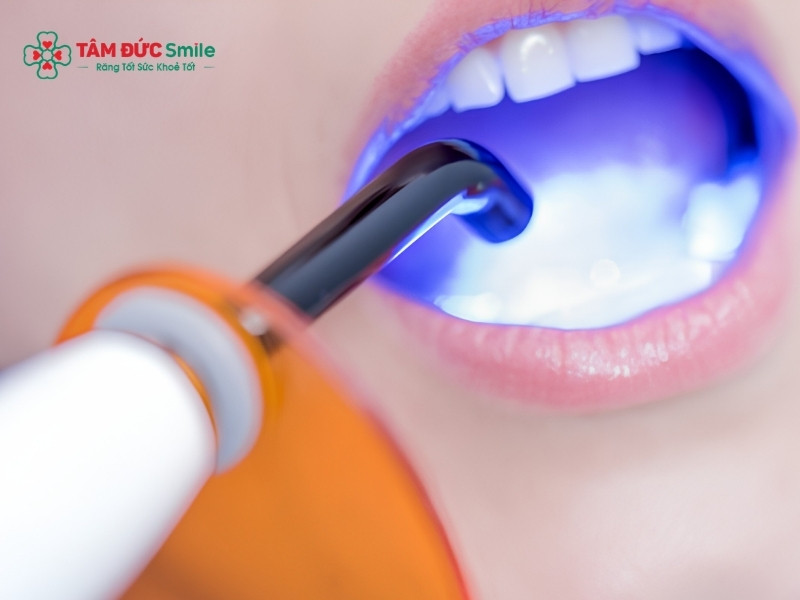 Ozon chữa ABC88 com đăng nhập không đau, không khoan, an toàn hiệu quả cao