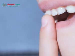 Răng lung lay có giữ được không?
