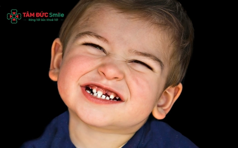 Cha mẹ nên thường xuyên kiểm tra răng bé; nếu thấy xuất hiện các đốm màu lạ hoặc lỗ li ti, đó chính là dấu hiệu của vi khuẩn ABC88 com đăng nhập