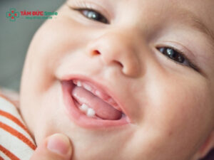 Trẻ em có bao nhiêu răng sữa? Giải đáp chi tiết