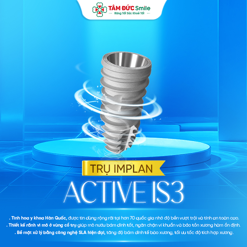 Trụ Implant Active IS3 – Giải pháp trồng răng hiện đại với độ bền cao và tích hợp xương nhanh