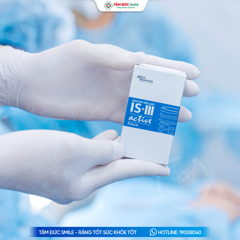 tru-implant-active-is3-7