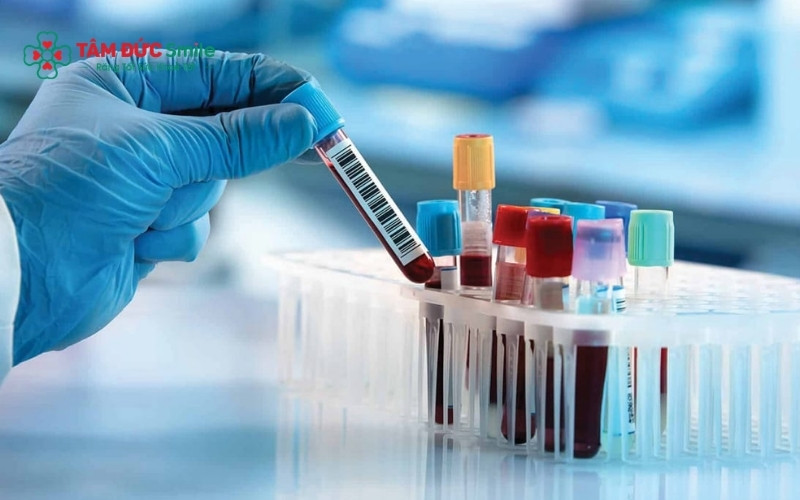 : Xét nghiệm máu là bước sàng lọc quan trọng giúp ABC8 đường link chính thức kiểm tra khả năng đông máu và các bệnh lý nền, nhằm kiểm soát tối đa rủi ro trong và sau khi nhổ răng