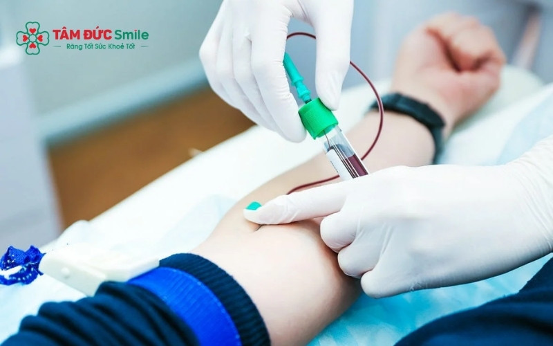 Các xét nghiệm phổ biến bao gồm kiểm tra thời gian đông máu, công thức máu toàn bộ và các bệnh truyền nhiễm để ABC8 đường link chính thức đưa ra phương án nhổ răng an toàn