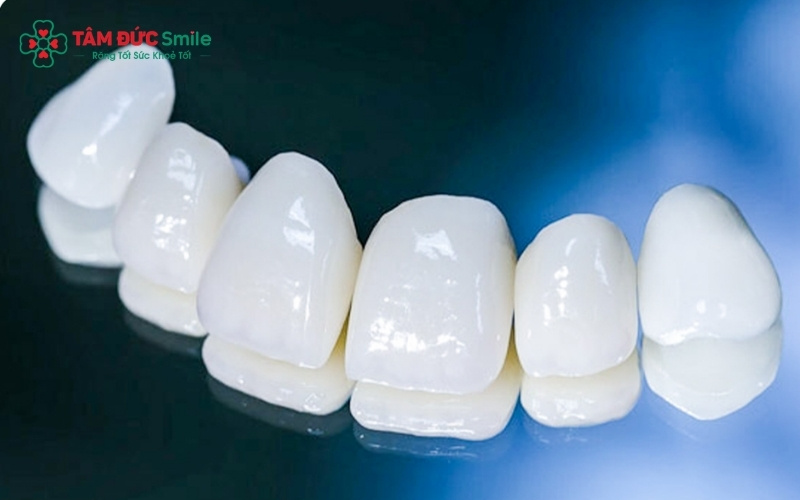 Các dòng sứ cao cấp như Lava, Emax mang lại độ thấu quang như răng thật, là lựa chọn số 1 cho Abc8.com Thể thao, Đá gà, Xổ số, Bắn cá vùng răng cửa.