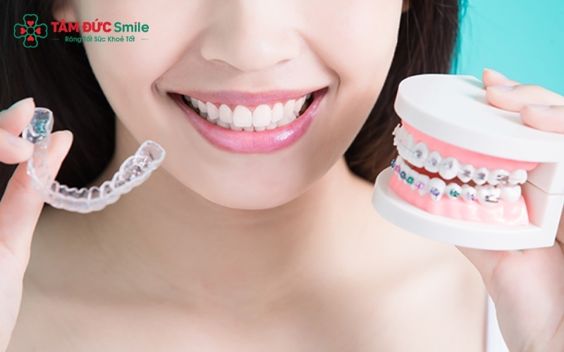  Có rất nhiều sự lựa chọn về thương hiệu khay niềng tùy thuộc vào tình trạng răng và tài chính của bạn.