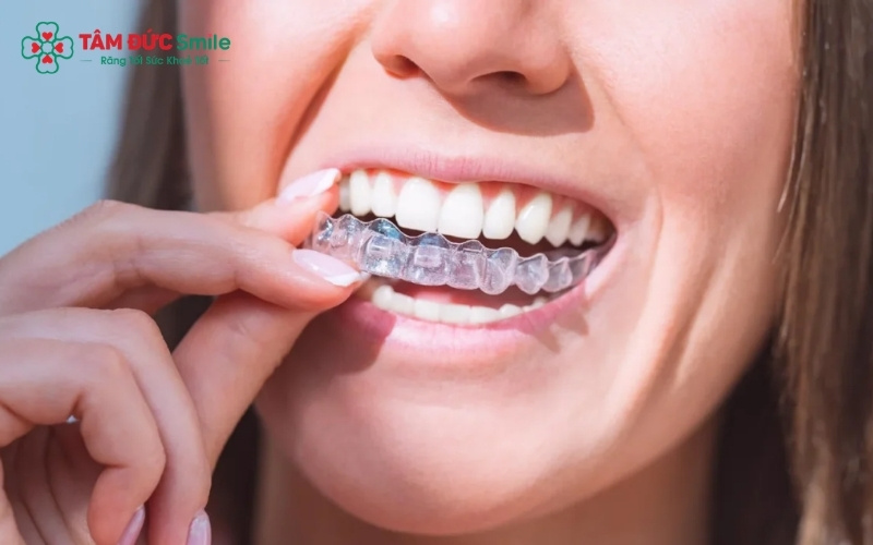 Sự đồng hành và giám sát chuyên môn của ABC8 đường link chính thức là yếu tố quyết định tính an toàn và hiệu quả của ca niềng.