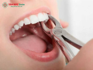 Abc88win đăng nhập cửa bao lâu thì trồng lại được?