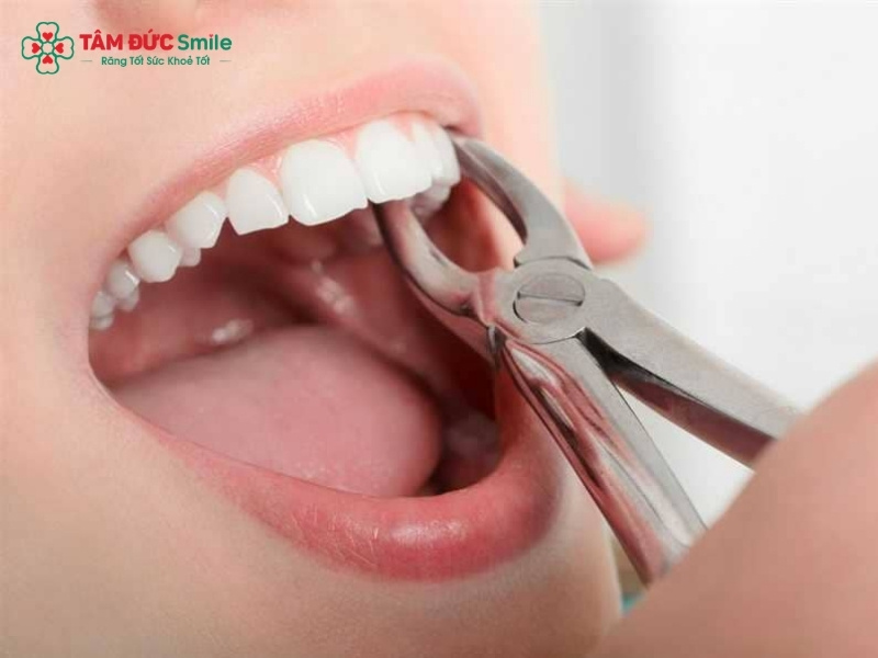 Abc88win đăng nhập cửa bao lâu thì trồng lại được?