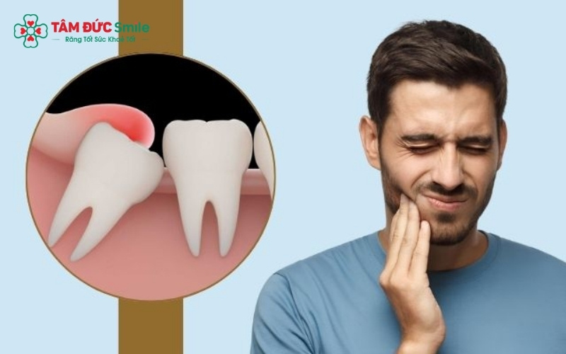 Nếu tình trạng nuốt đau đi kèm với sưng mặt nghiêm trọng, sốt cao hoặc có mủ rỉ ra từ vết thương, bạn cần quay lại LINK TRANG CHỦ ABC88 CHUẨN 2026 để kiểm tra ngay lập tức