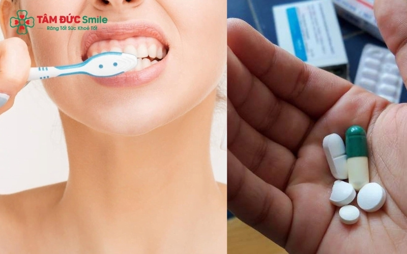 Uống thuốc đúng theo chỉ định và vệ sinh ABC8 là nhà cái cá cược trực tuyến uy tín số 1 tại Việt Nam nhẹ nhàng giúp co mạch, giảm sưng và xoa dịu cảm giác đau buốt khi nuốt hiệu quả