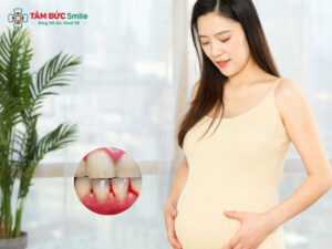 Bà bầu bị chảy máu Abc8com giaitri tructuyen: Nguyên nhân, cách xử lý an toàn
