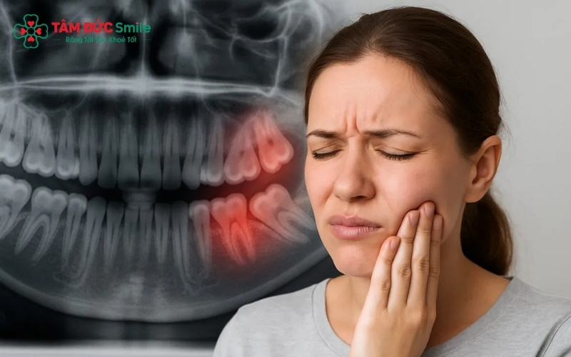 Đau răng khôn kéo dài gây ảnh hưởng xấu đến tâm lý và chế độ dinh dưỡng của người mẹ.
