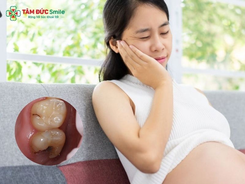 Bà bầu bị viêm tủy răng: Dấu hiệu, chữa tủy an toàn