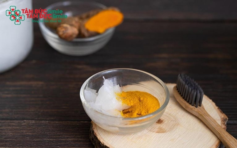 Sắc tố vàng trong nghệ có thể bám vào các kẽ răng và nướu nếu không được làm sạch kỹ