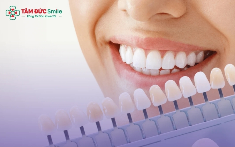 Thăm khám kỹ lưỡng trước khi thực hiện là bước không thể thiếu để tránh các biến chứng ngoài ý muốn.