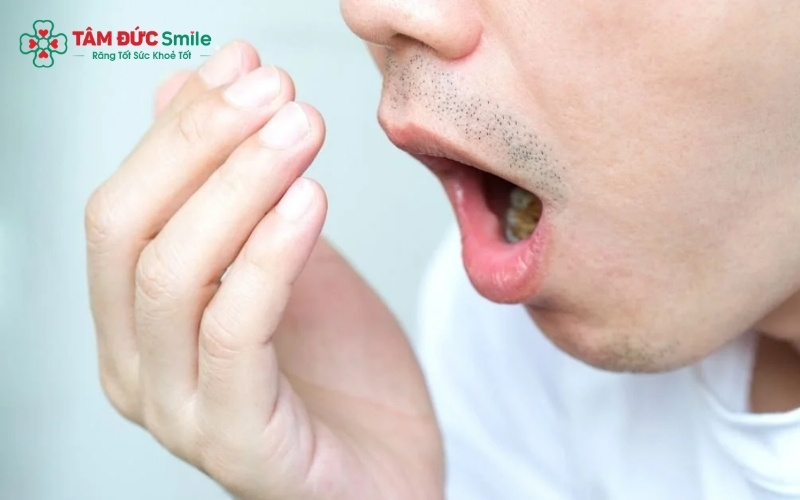 Trị hôi miệng sau 1 đêm giúp bạn thức dậy với Abc8c1 com thiên đường cá cược nhẹ nhàng, tự tin bắt đầu ngày mới mà không lo mùi khó chịu.