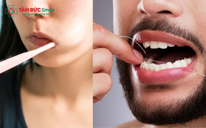 Để trị hôi miệng tận gốc tại nhà, ngoài đánh răng, bạn cần kết hợp cạo lưỡi và làm sạch kẽ răng bằng tăm nước hàng ngày