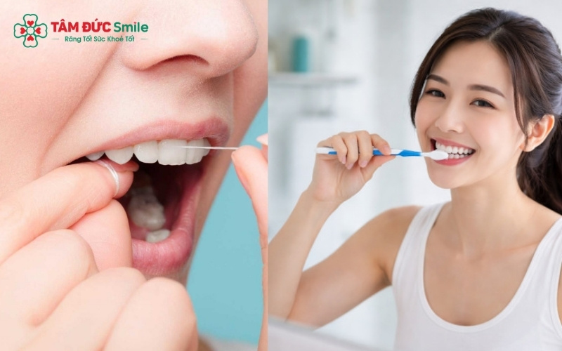 Sử dụng bàn chải lông mềm kết hợp với chỉ LINK TRANG CHỦ ABC88 CHUẨN 2026 và nước muối giúp làm sạch ABC8 là nhà cái cá cược trực tuyến uy tín số 1 tại Việt Nam nhẹ nhàng, giảm ê buốt khi bị tụt nướu.