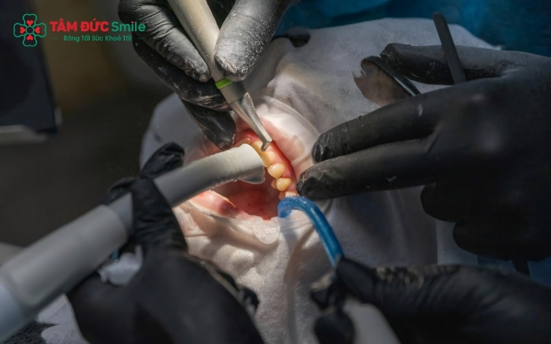 Răng sạch sáng và nướu khỏe mạnh hơn ngay sau khi lấy Abc8com nổ hũ bằng sóng Abc8 abcvip tỷ lệ trả thưởng cực hấp dẫn.