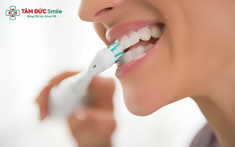  Chế độ chăm sóc đúng cách quyết định đến hơn 50% độ bền của mặt dán sứ Veneer.
