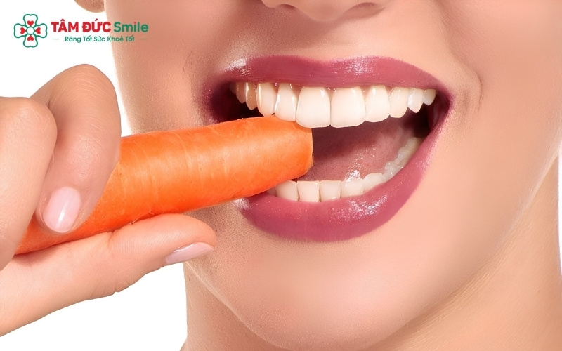 Hạn chế đồ ăn quá cứng, quá dai để bảo vệ mặt dán Veneer lâu dài.
