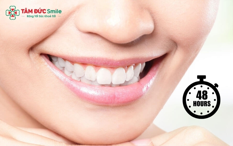 48 giờ đầu tiên là thời điểm quan trọng nhất để kiêng các thực phẩm màu, giúp màu răng ổn định và bền lâu
