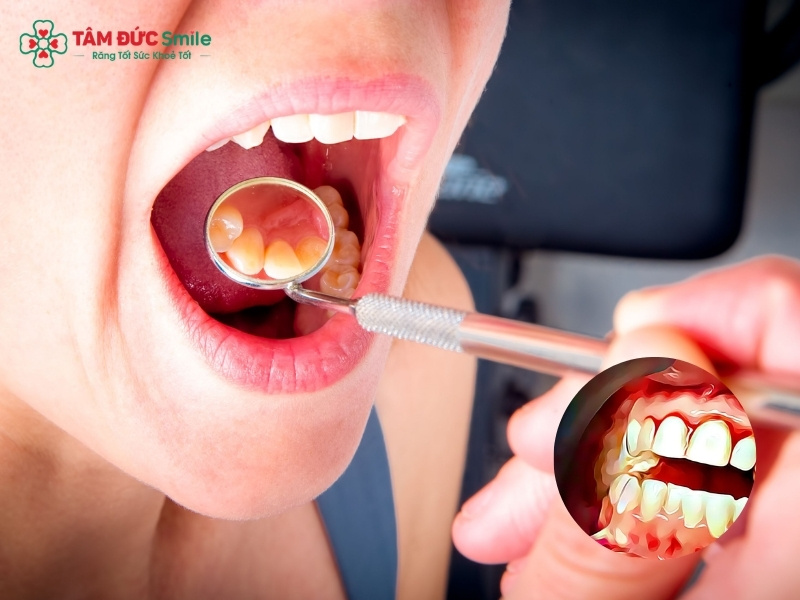 Chảy máu Abc8com giaitri tructuyen không cầm được: Nguyên nhân, cách xử lý