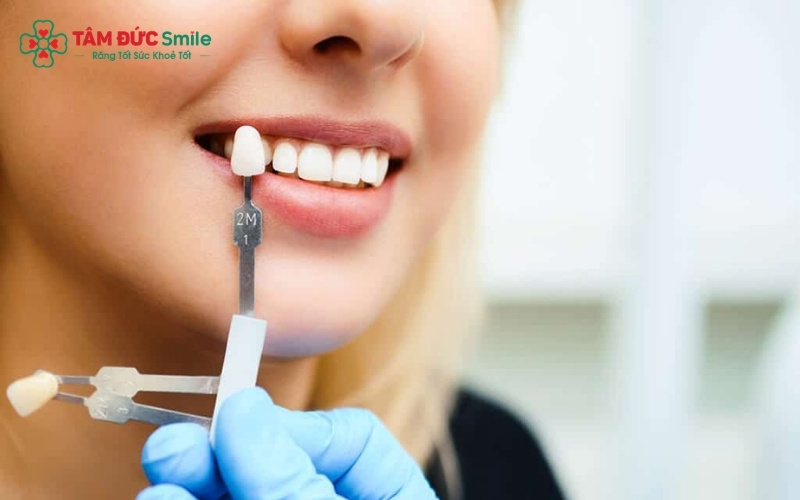 Ưu điểm lớn nhất của Veneer cho răng hô là tỉ lệ mài răng cực ít, không xâm phạm đến tủy răng và không gây ê buốt.