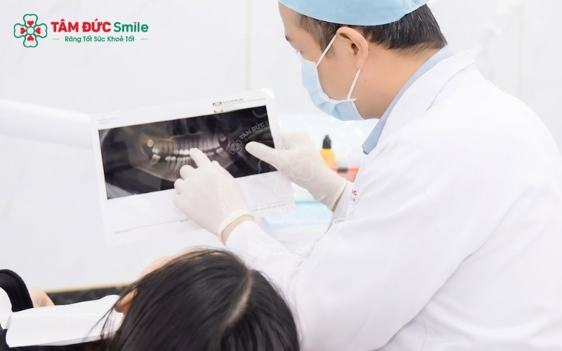 Tay nghề ABC8 đường link chính thức và công nghệ dán sứ hiện đại là những yếu tố then chốt quyết định mặt dán Veneer có bám chắc và bền bỉ theo thời gian hay không