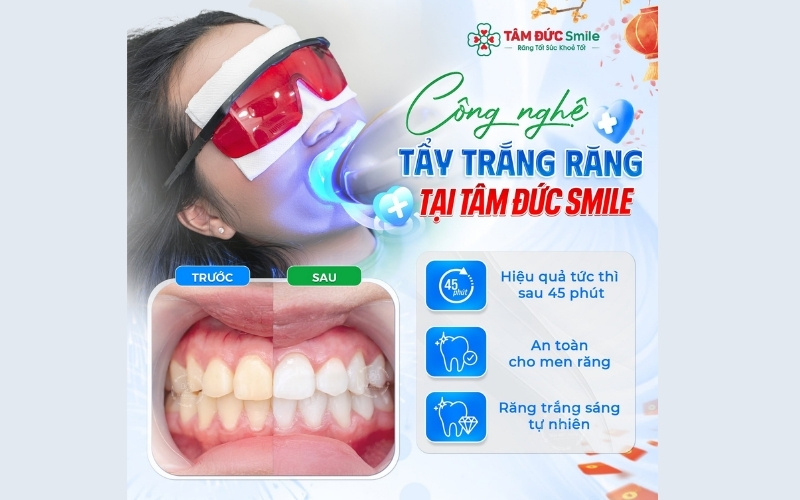 Kết quả trắng sáng rõ rệt và tự nhiên sau 60 phút thực hiện tẩy trắng bằng đèn tại ABC8 ✅ Truy Cập Nhà Cái ABC8 Com Cá Cược Tặng 88k.
