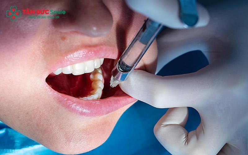 Thuốc tê thường hết tác dụng sau 1 - 3 giờ tùy cơ địa; ABC8 đường link chính thức sẽ hướng dẫn bạn cách chăm sóc và dùng thuốc giảm đau để giai đoạn hậu phẫu diễn ra êm ái nhất