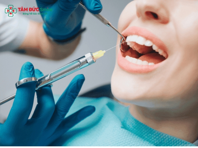 Gây tê nhổ răng có đau không? Thuốc tê bao lâu hết tác dụng