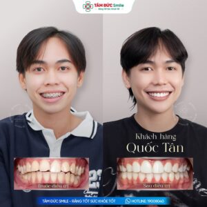 khach-hang-quoc-tan