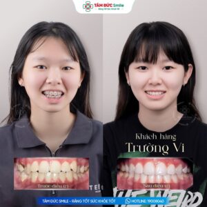 khach-hang-truong-vi