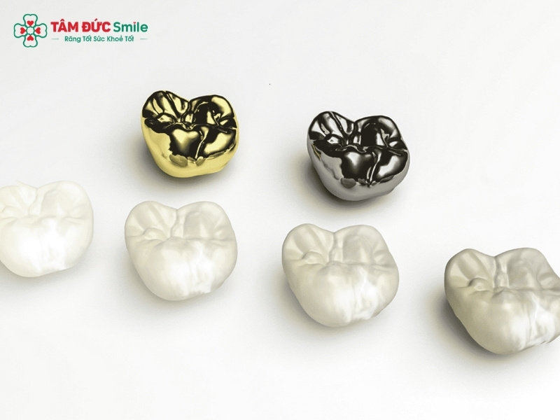 Nên Abc8.com Thể thao, Đá gà, Xổ số, Bắn cá loại nào tốt? So sánh răng toàn sứ, Cercon