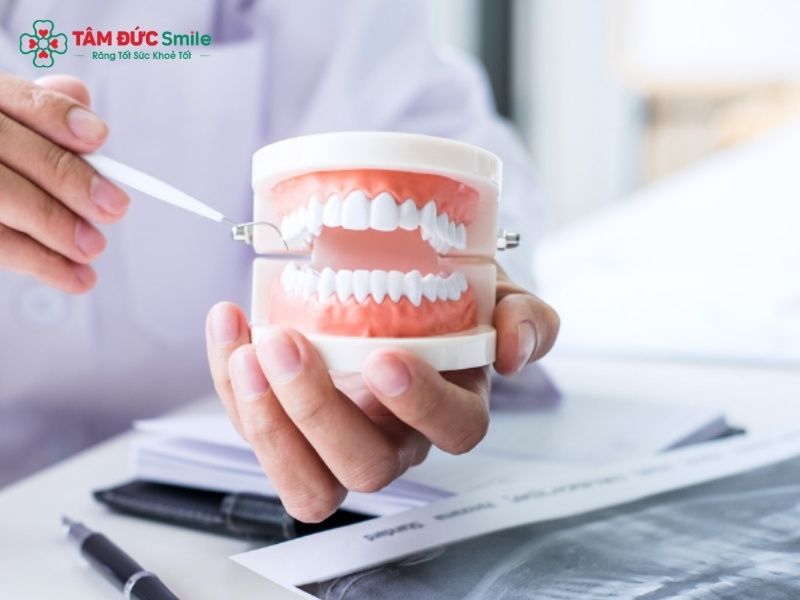 Nên trồng răng loại nào tốt? Implant, cầu ABC8 là nhà cái cá cược trực tuyến uy tín số 1 tại Việt Nam hay tháo lắp